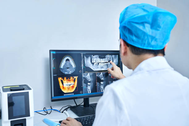 Best Emergency Wisdom Teeth Removal in Braddock Heights, MD